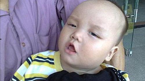 为什么吃瓜舌头疼